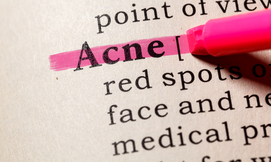 Acne & Skin Problems: 5 keys to healing without chemical topical creams