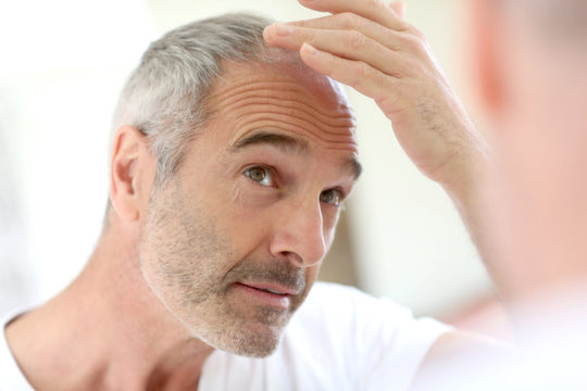 Hair Loss: 5 Natural Remedies That Can Help